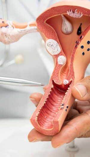 Expert gynecologist Services in Patiala