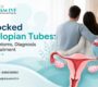 Blocked Fallopian Tubes Symptoms Diagnosis Treatment 90x80